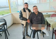 PROTEZLERİ UYMUYOR, HAYATA TUTUNMAYA ÇALIŞIYOR