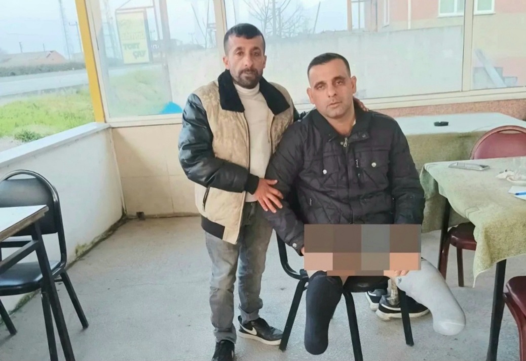 PROTEZLERİ UYMUYOR, HAYATA TUTUNMAYA ÇALIŞIYOR